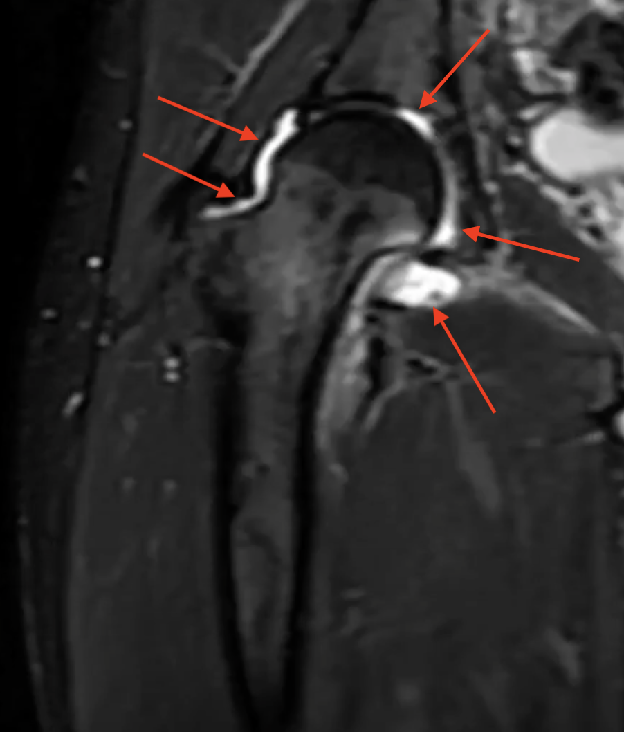 first-mri-img-1