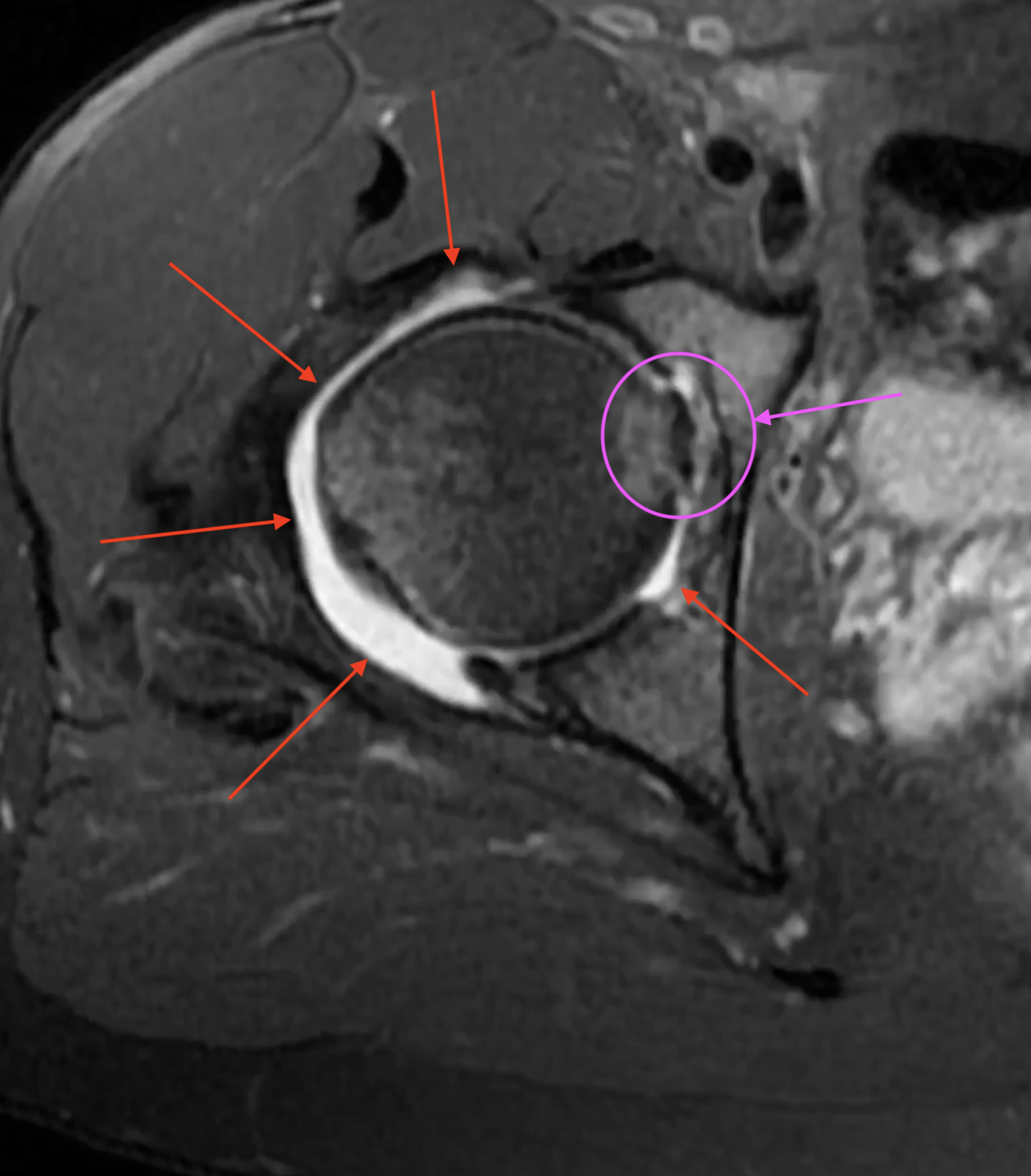 first-mri-img-2