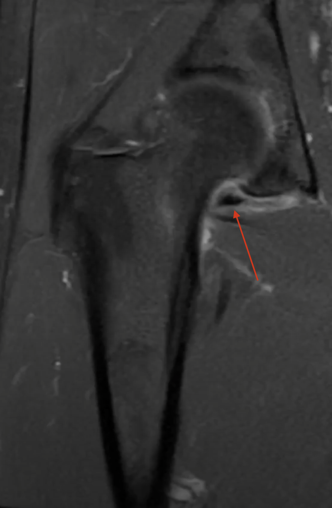 second-mri-img-1