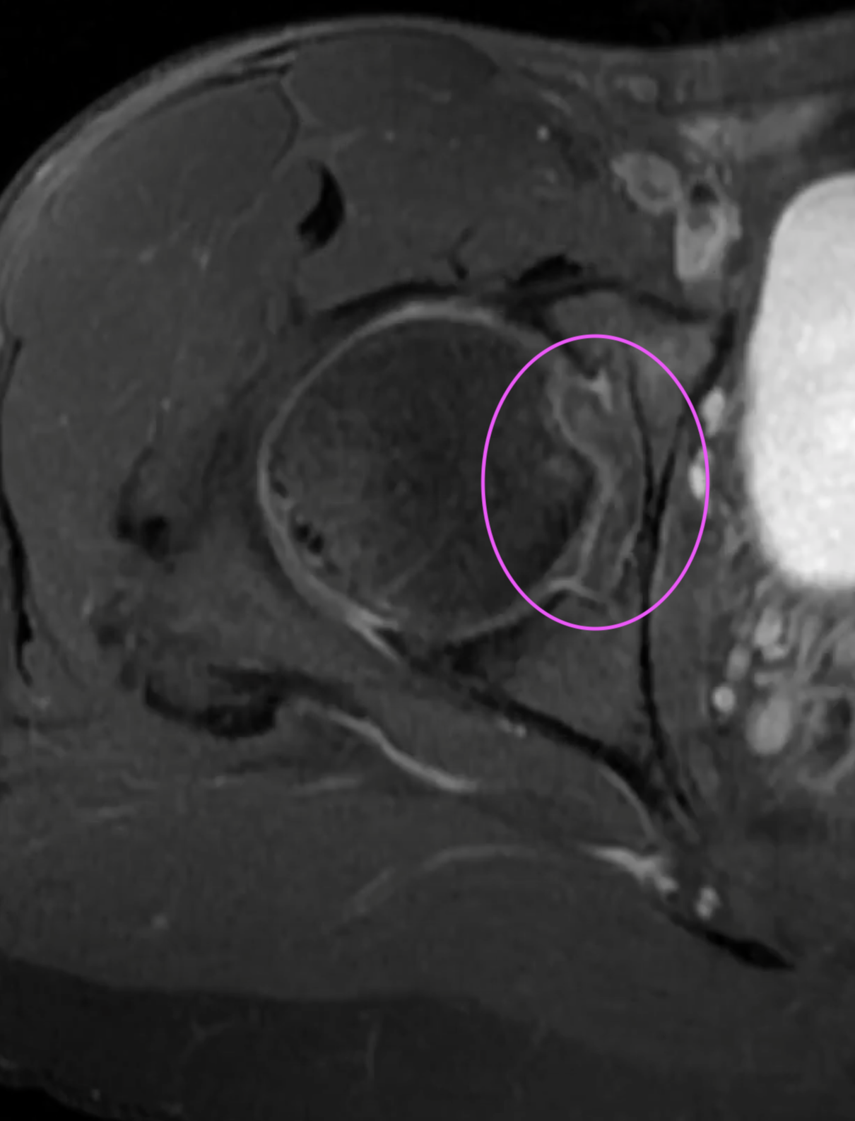 second-mri-img-2